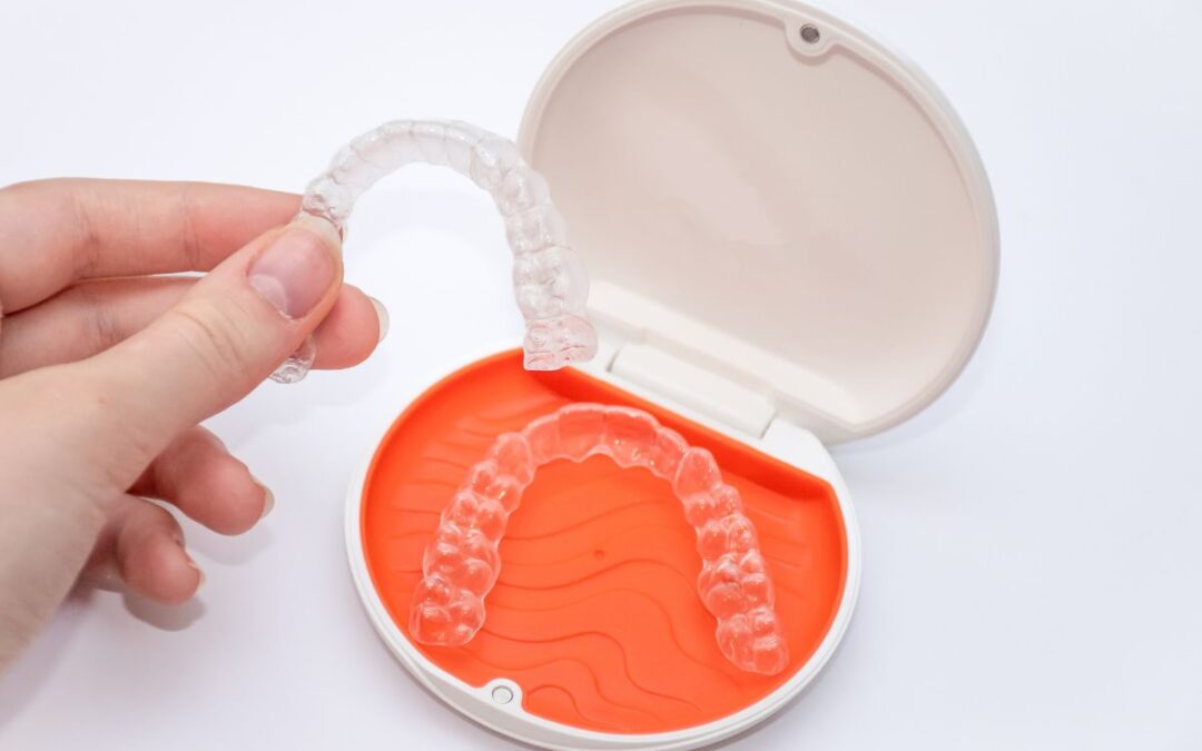 clear aligners