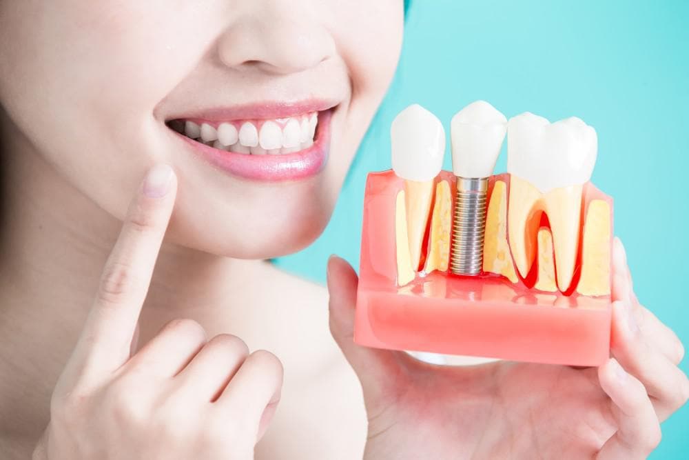 your essential guide to getting dental implants image