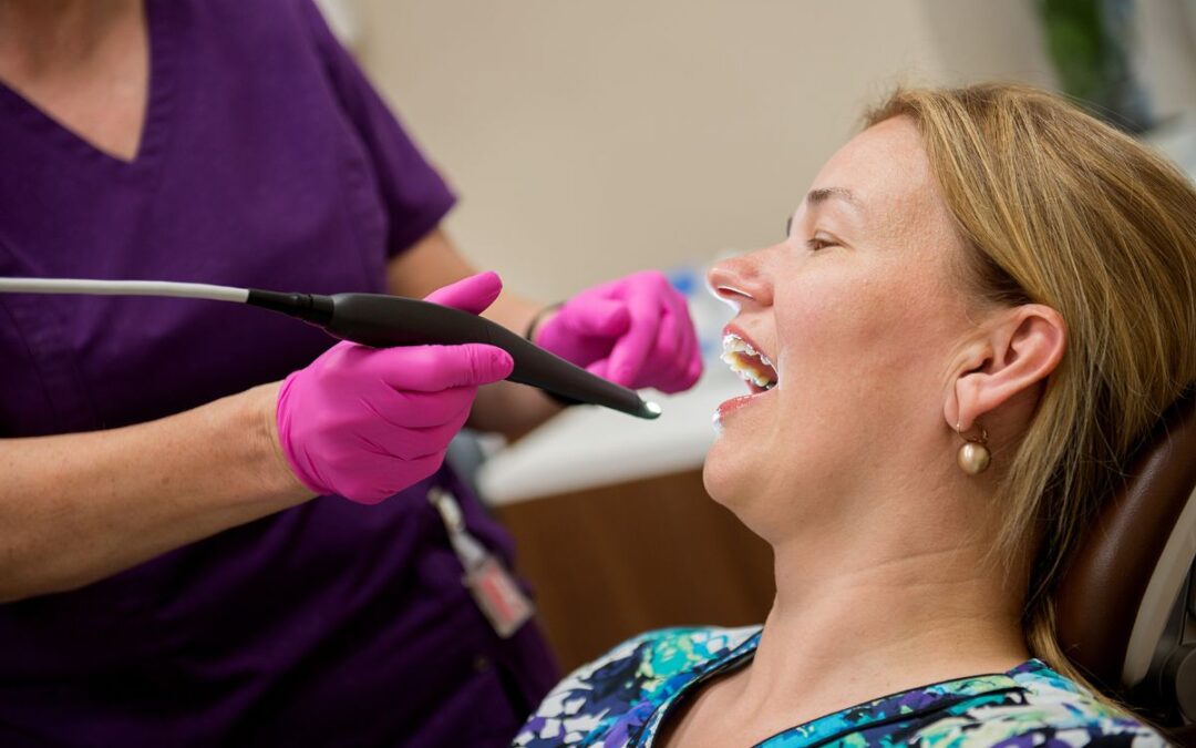 Which Whitening Treatment is Best?