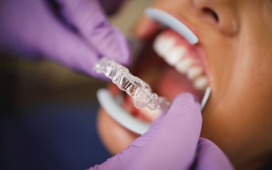 What Should I Do If My Invisalign Feels Uncomfortable?