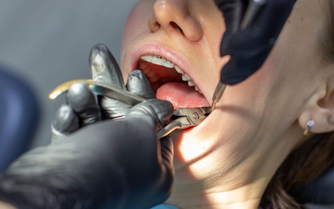Why Dental Braces Need Regular Tightening?