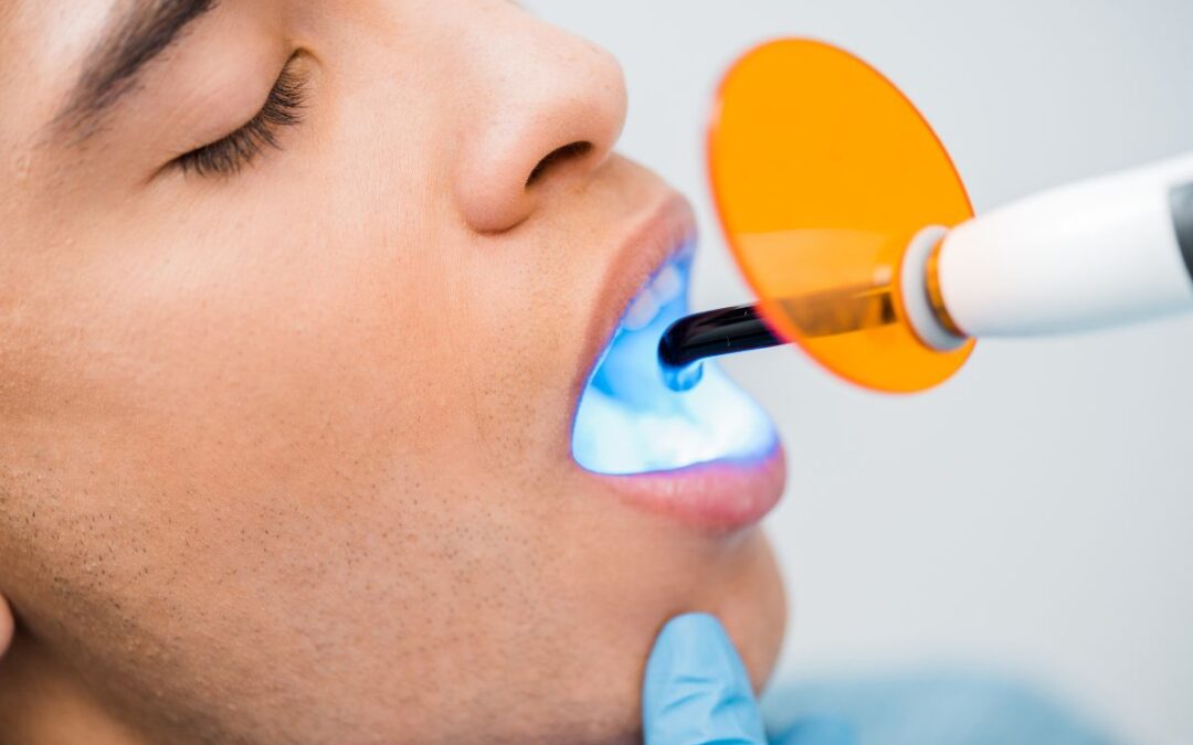 How to Choose Between Teeth Whitening and Zoom Whitening?