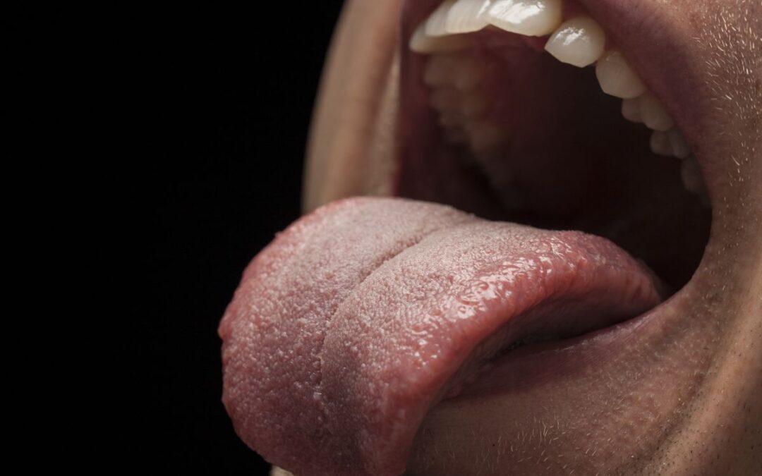 Is a Tongue Bump Normal or a Cause for Concern?