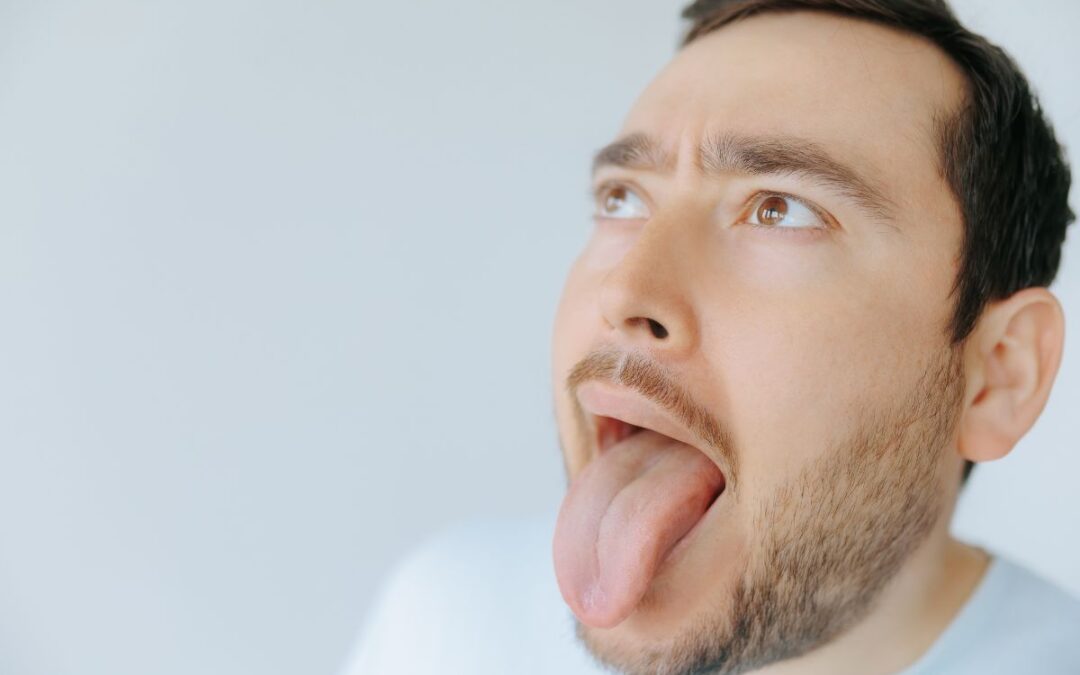 How To Treat Bad Breath From Dry Mouth Effectively?