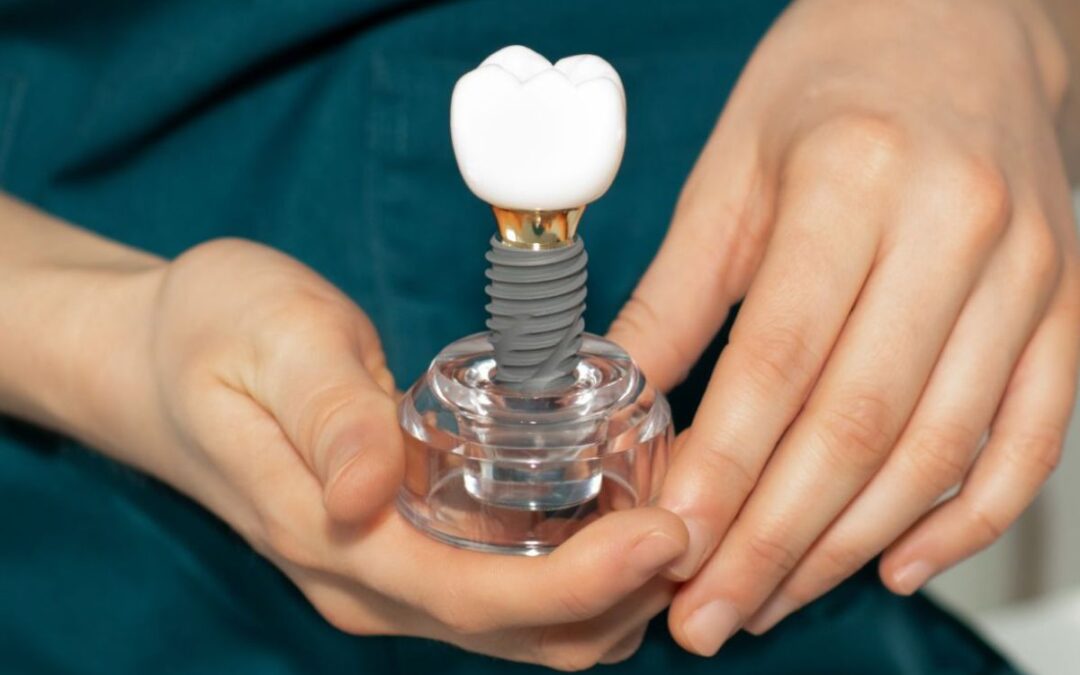 Can Dental Implants Cause a Constant Bitter Taste?