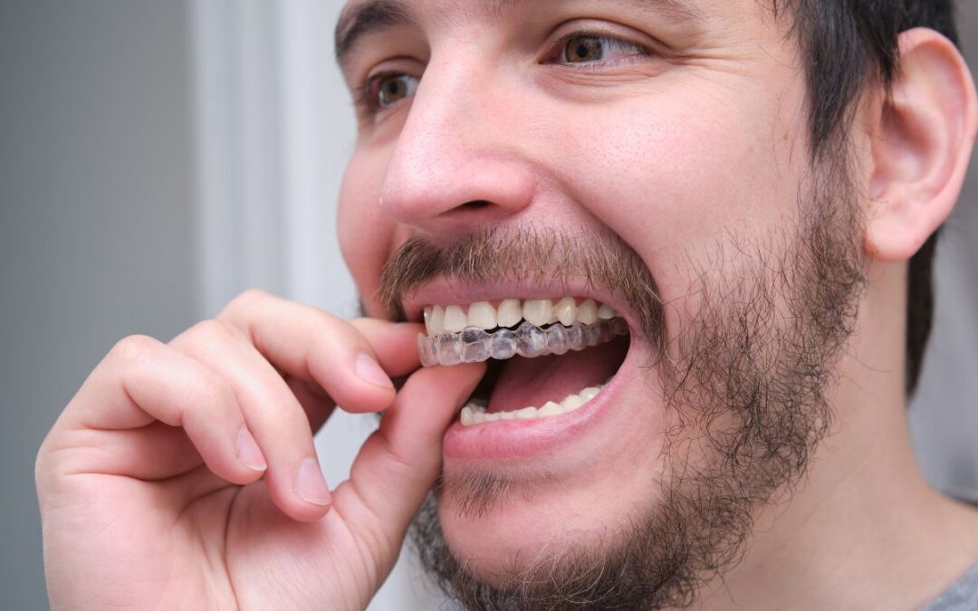 Invisalign With Receding Gums